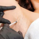 Hair Boosters, PRP, GFC, Deuasteride, Mesotherapy, QR678
